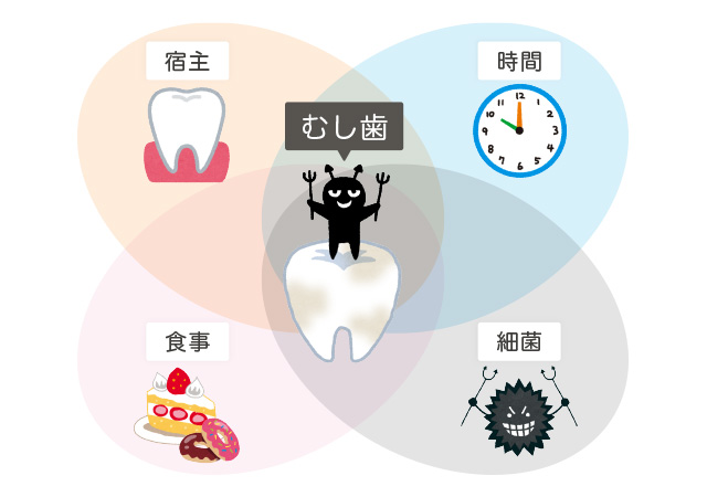 むし歯のリスク